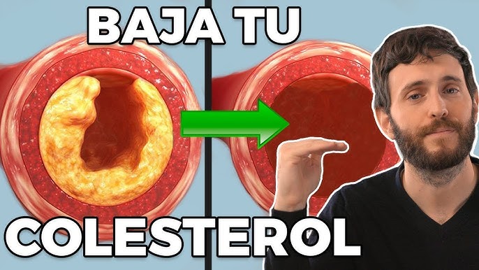 Baja Tu Colesterol y Limpia Tus Arterias Así 1 Baja Tu Colesterol y Limpia Tus Arterias Así